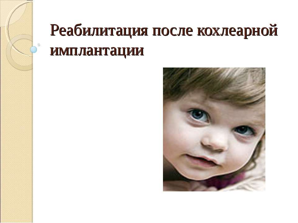 Реабилитация после кохлеарной имплантации Учебники, Презентации и Подготовка к Экзаменам для Школьников на Klass-Uchebnik.com