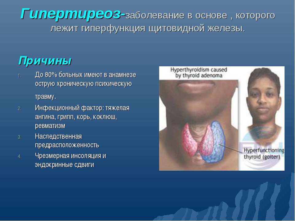 Гипертиреоз Учебники, Презентации и Подготовка к Экзаменам для Школьников на Klass-Uchebnik.com