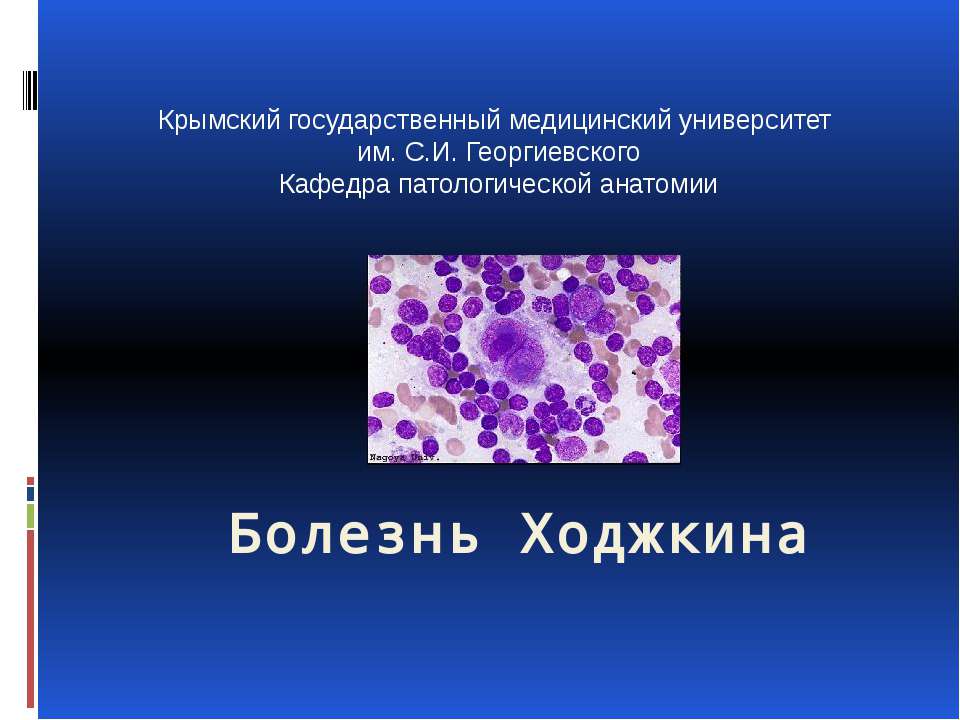 Болезнь Ходжкина Учебники, Презентации и Подготовка к Экзаменам для Школьников на Klass-Uchebnik.com