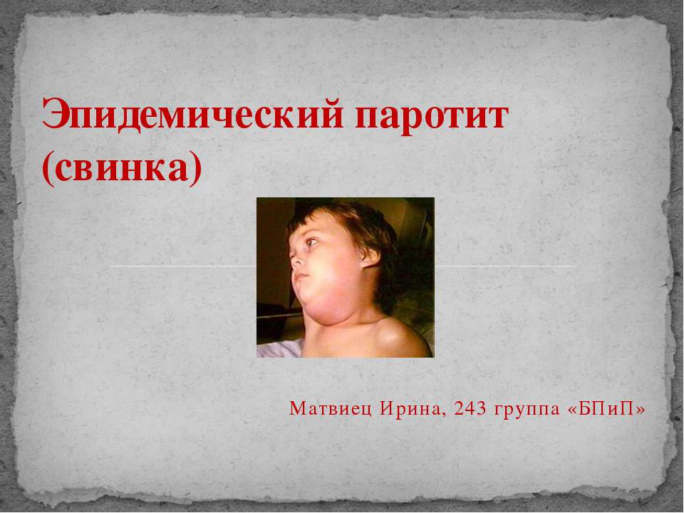Эпидемический паротит (свинка) Учебники, Презентации и Подготовка к Экзаменам для Школьников на Klass-Uchebnik.com