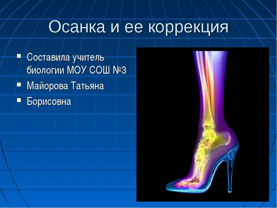 Осанка и ее коррекция Учебники, Презентации и Подготовка к Экзаменам для Школьников на Klass-Uchebnik.com
