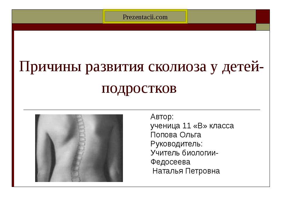 Причины развития сколиоза у детей-подростков Учебники, Презентации и Подготовка к Экзаменам для Школьников на Klass-Uchebnik.com