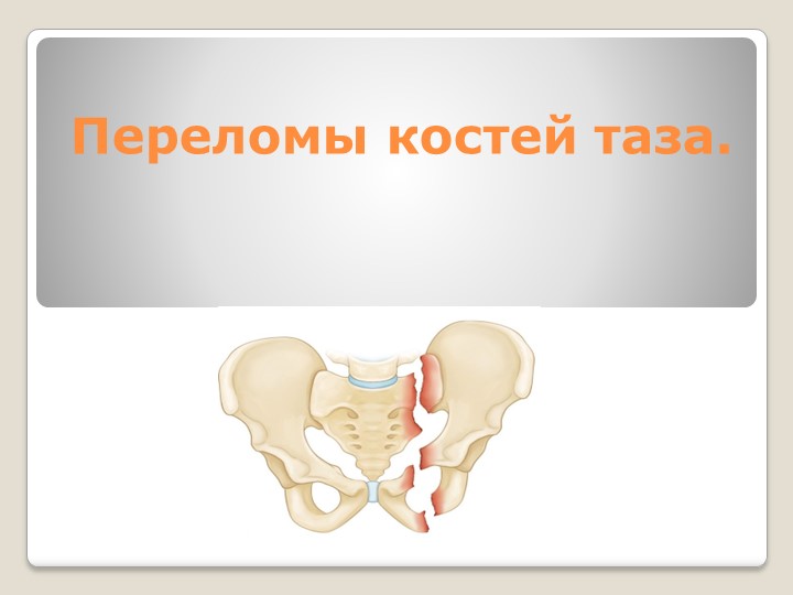 Презентация по анатомии и физиологии человека по теме:"Переломы костей таза." - Учебники, Презентации и Подготовка к Экзаменам для Школьников на Klass-Uchebnik.com