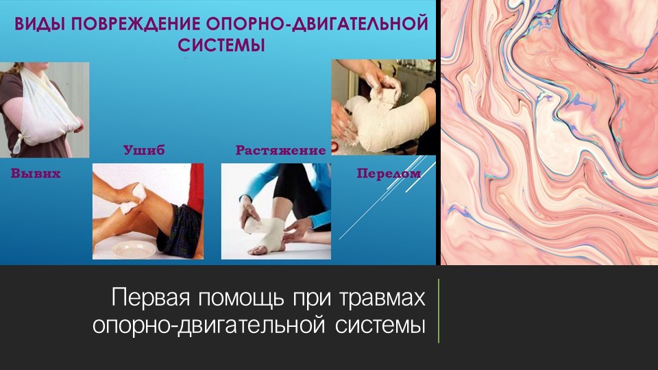 Презентация по биологии "Первая помощь при травмах опорно-двигательной системы" - Учебники, Презентации и Подготовка к Экзаменам для Школьников на Klass-Uchebnik.com