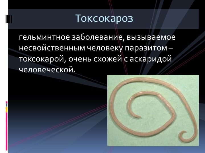 Презентация по ПМ 01 Проведение профилактических мероприятий на тему: " Токсокароз" - Учебники, Презентации и Подготовка к Экзаменам для Школьников на Klass-Uchebnik.com