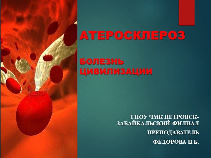 Презентация "Атеросклероз. Болезнь цивилизации" Учебники, Презентации и Подготовка к Экзаменам для Школьников на Klass-Uchebnik.com