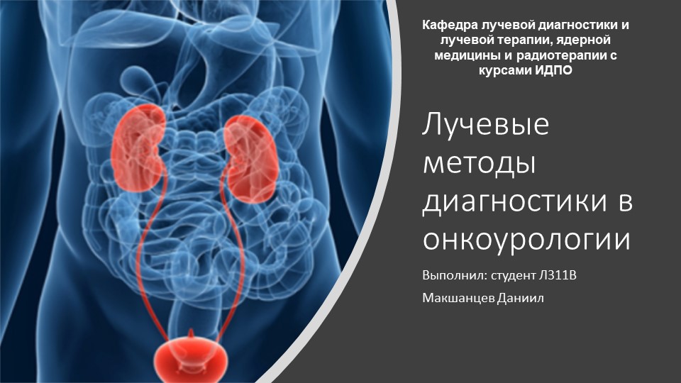 Презентация на тему: "Лучевая диагностика в онкоурологии" Учебники, Презентации и Подготовка к Экзаменам для Школьников на Klass-Uchebnik.com
